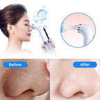 Vacuum Pore Cleaner | Mini Hydra Facial Device Super Micro Bubble Beauty Instrument Black Head Remover